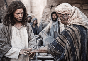 leprosy-history-jesus